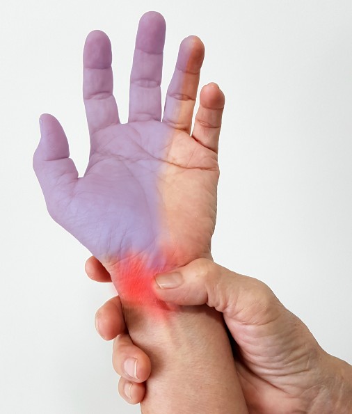 Carpal Tunnel Syndrome St.George Utah Hand Surgery