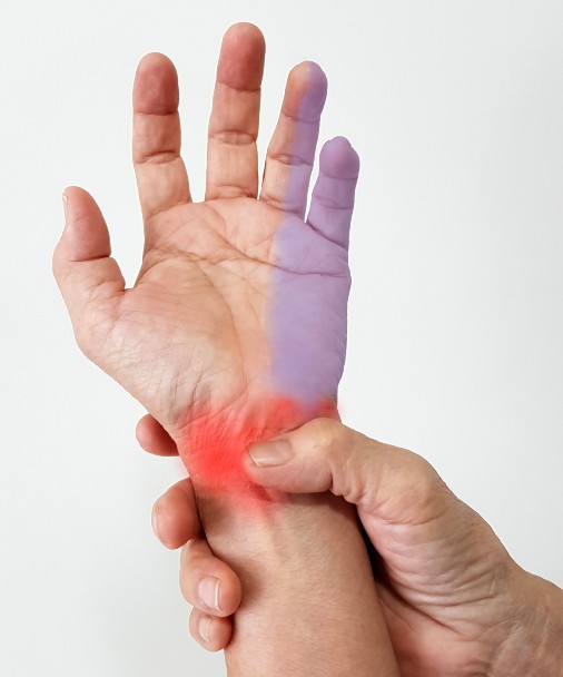Cubital Tunnel Syndrome St.George Utah Hand Surgery