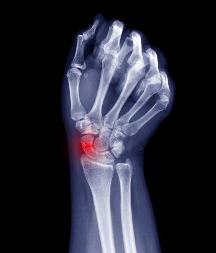 Hand & Wrist Injury St.George Hand Surgery