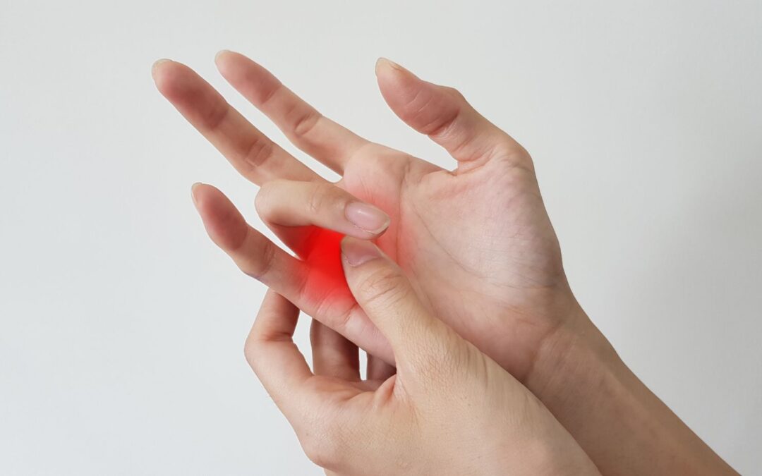 What-is-Trigger-Finger-St.George-Hand-Surgery
