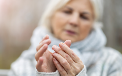 Recognizing the First Signs of Arthritis in Your Hands